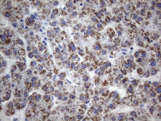 CD248 Antibody in Immunohistochemistry (Paraffin) (IHC (P))
