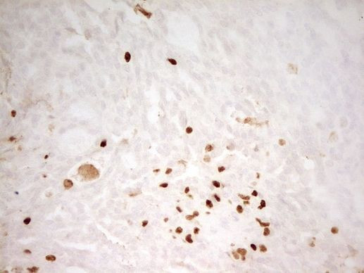 Myeloid Specific Antigen Antibody in Immunohistochemistry (Paraffin) (IHC (P))