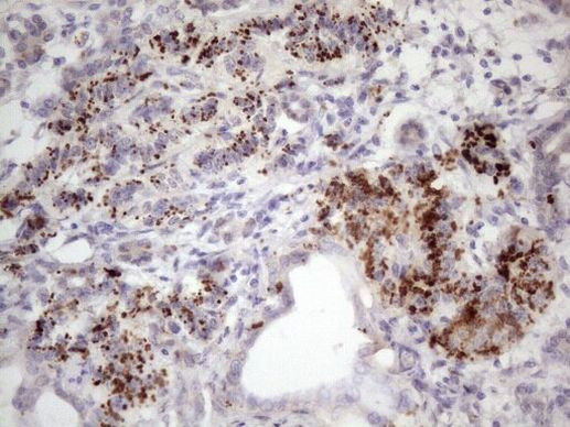 INAVA Antibody in Immunohistochemistry (Paraffin) (IHC (P))