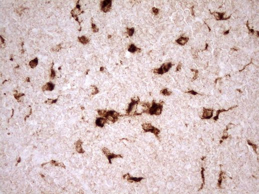 Renin Antibody in Immunohistochemistry (Paraffin) (IHC (P))