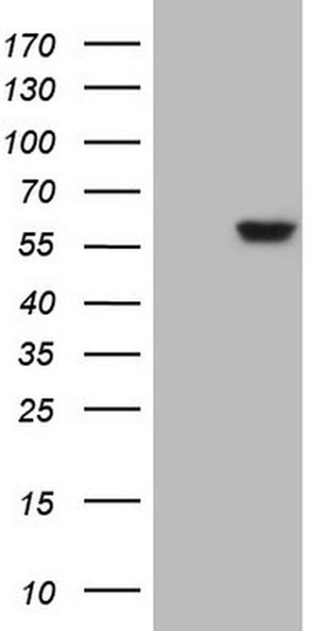ANGPTL3 Antibody in Western Blot (WB)