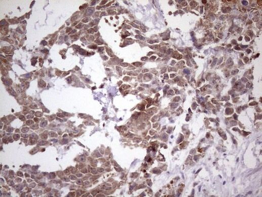 NUP43 Antibody in Immunohistochemistry (Paraffin) (IHC (P))