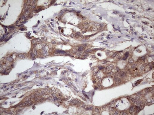 WDR61 Antibody in Immunohistochemistry (Paraffin) (IHC (P))