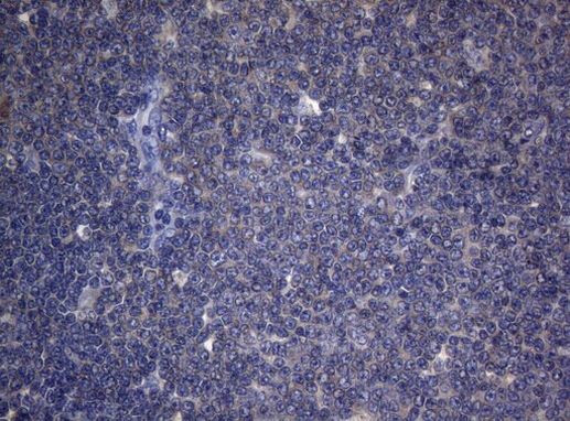CDCA8 Antibody in Immunohistochemistry (Paraffin) (IHC (P))