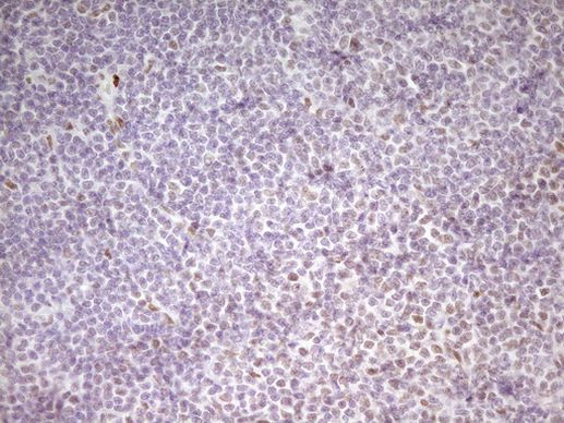 MEF2D Antibody in Immunohistochemistry (Paraffin) (IHC (P))