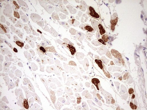MYL4 Antibody in Immunohistochemistry (Paraffin) (IHC (P))