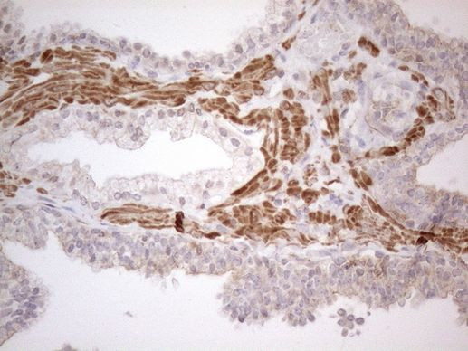 ATF1 Antibody in Immunohistochemistry (Paraffin) (IHC (P))