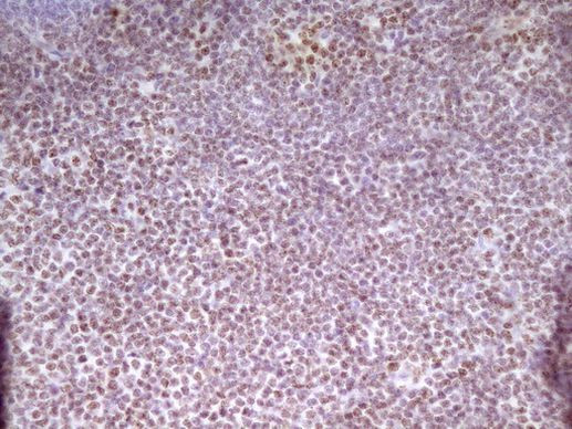 SP110 Antibody in Immunohistochemistry (Paraffin) (IHC (P))