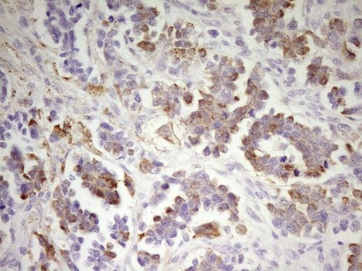 PCQAP Antibody in Immunohistochemistry (Paraffin) (IHC (P))
