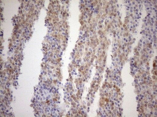 BOB-1 Antibody in Immunohistochemistry (Paraffin) (IHC (P))