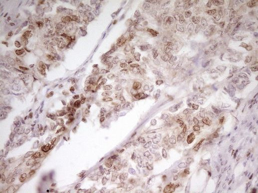 SP110 Antibody in Immunohistochemistry (Paraffin) (IHC (P))