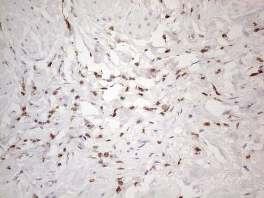 SNRPB2 Antibody in Immunohistochemistry (Paraffin) (IHC (P))