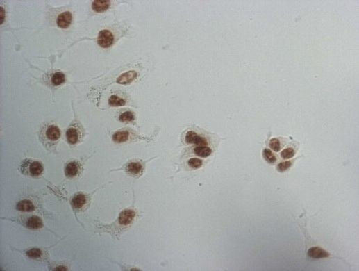 SNRPB2 Antibody in Immunocytochemistry (ICC/IF)