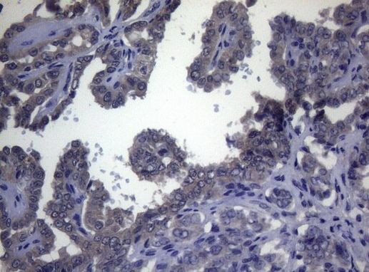 FOXQ1 Antibody in Immunohistochemistry (Paraffin) (IHC (P))