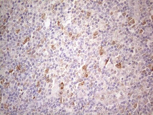 PSMG2 Antibody in Immunohistochemistry (Paraffin) (IHC (P))