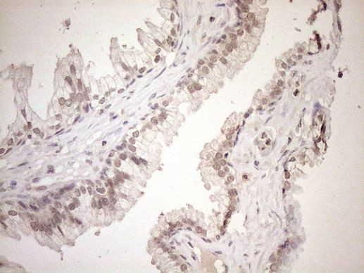 ASB2 Antibody in Immunohistochemistry (Paraffin) (IHC (P))