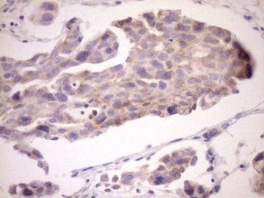 eIF3d Antibody in Immunohistochemistry (Paraffin) (IHC (P))