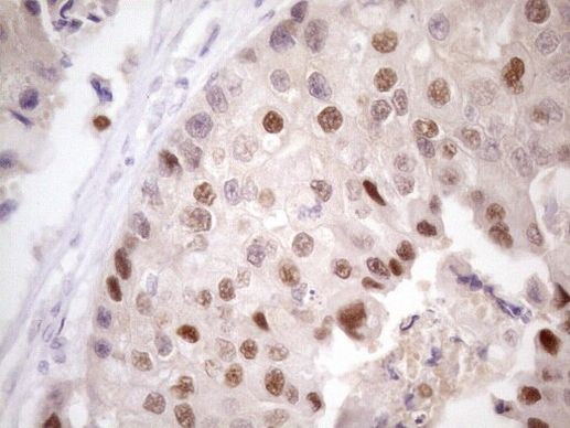 ZNF200 Antibody in Immunohistochemistry (Paraffin) (IHC (P))