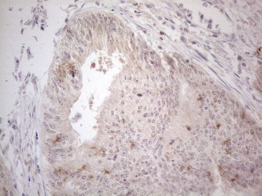 ZNF200 Antibody in Immunohistochemistry (Paraffin) (IHC (P))