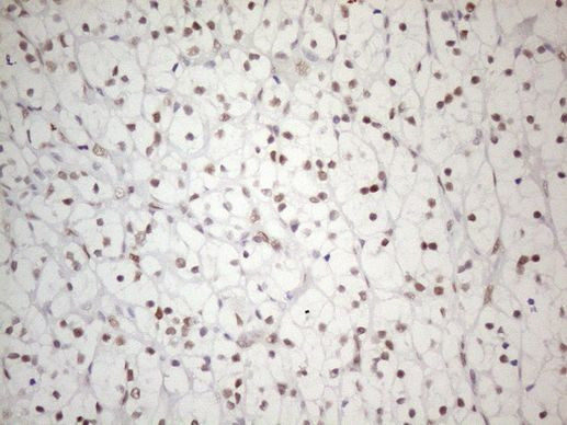 PRPK Antibody in Immunohistochemistry (Paraffin) (IHC (P))