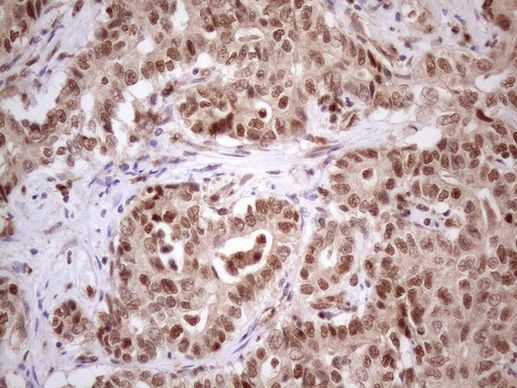 PRPK Antibody in Immunohistochemistry (Paraffin) (IHC (P))