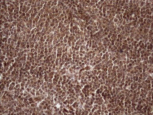 MGC12965 Antibody in Immunohistochemistry (Paraffin) (IHC (P))
