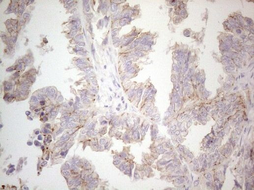 MGC12965 Antibody in Immunohistochemistry (Paraffin) (IHC (P))