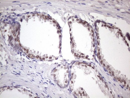 SRSF9 Antibody in Immunohistochemistry (Paraffin) (IHC (P))