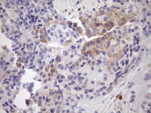 NOBOX Antibody in Immunohistochemistry (Paraffin) (IHC (P))