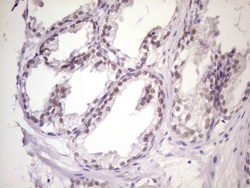 MKX Antibody in Immunohistochemistry (Paraffin) (IHC (P))