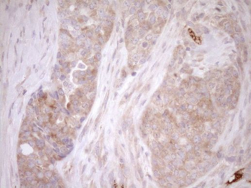 Melanophilin Antibody in Immunohistochemistry (Paraffin) (IHC (P))