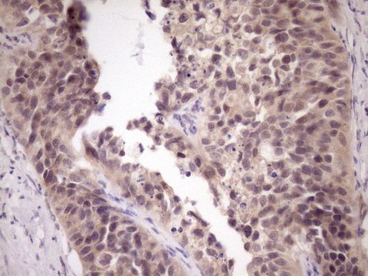 ZNF449 Antibody in Immunohistochemistry (Paraffin) (IHC (P))