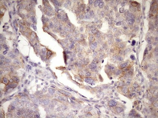 MCEE Antibody in Immunohistochemistry (Paraffin) (IHC (P))