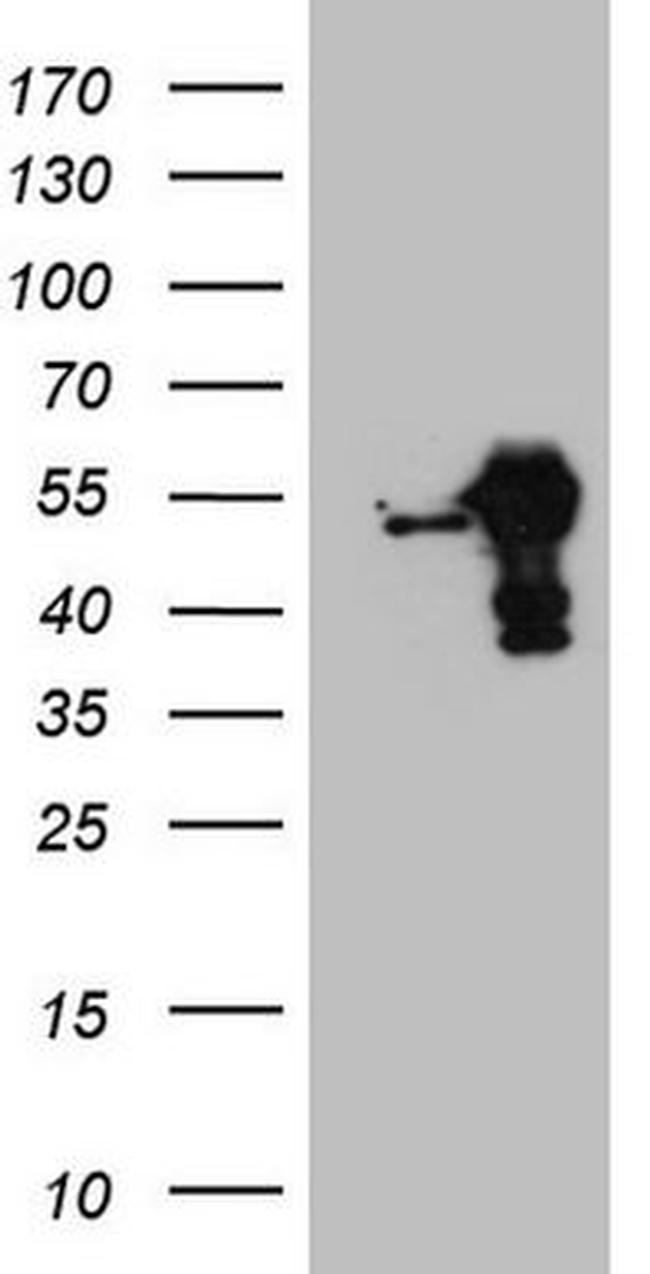 RBMS1 Antibody in Western Blot (WB)
