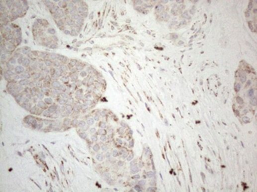 DLX4 Antibody in Immunohistochemistry (Paraffin) (IHC (P))
