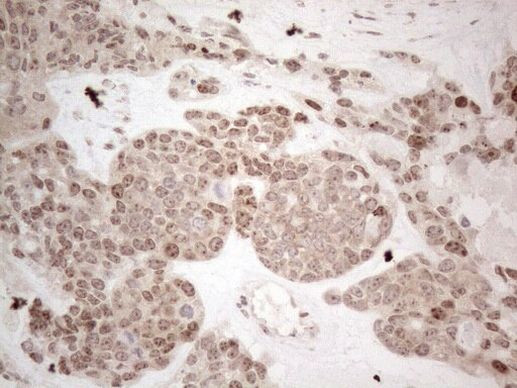 HMGB4 Antibody in Immunohistochemistry (Paraffin) (IHC (P))