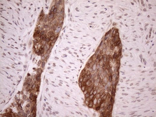 Aladin Antibody in Immunohistochemistry (Paraffin) (IHC (P))