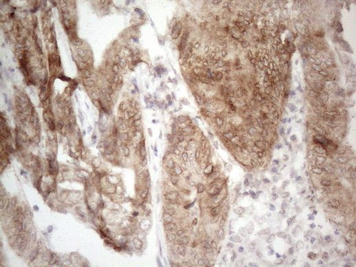 Aladin Antibody in Immunohistochemistry (Paraffin) (IHC (P))