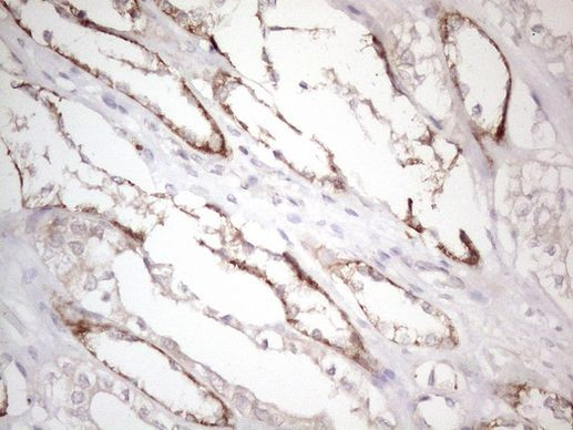 CTDSP2 Antibody in Immunohistochemistry (Paraffin) (IHC (P))
