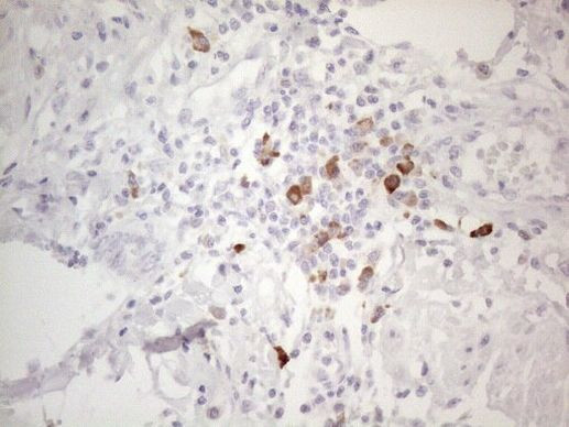 TTC14 Antibody in Immunohistochemistry (Paraffin) (IHC (P))