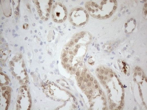 RPS6KC1 Antibody in Immunohistochemistry (Paraffin) (IHC (P))