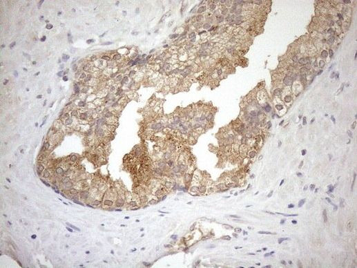 NGDN Antibody in Immunohistochemistry (Paraffin) (IHC (P))