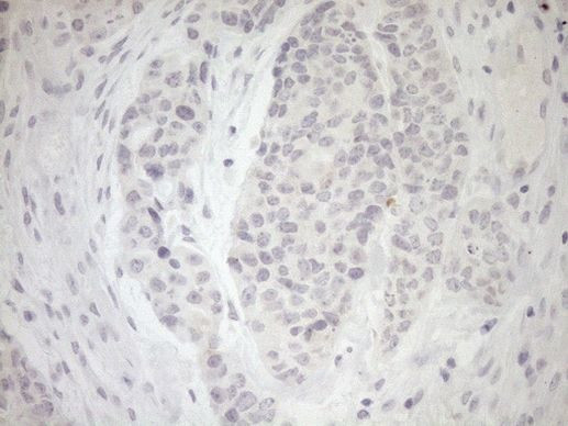 MYOZ1 Antibody in Immunohistochemistry (Paraffin) (IHC (P))