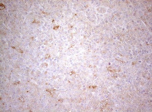 PTK9 Antibody in Immunohistochemistry (Paraffin) (IHC (P))
