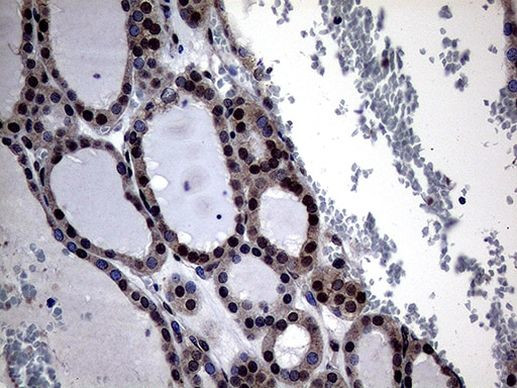 OSGIN2 Antibody in Immunohistochemistry (Paraffin) (IHC (P))
