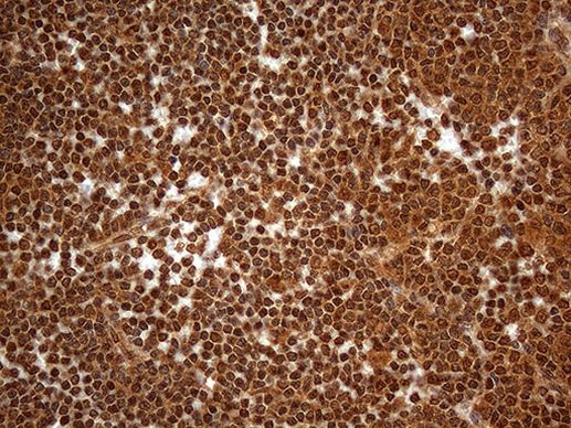 SPANXN3 Antibody in Immunohistochemistry (Paraffin) (IHC (P))