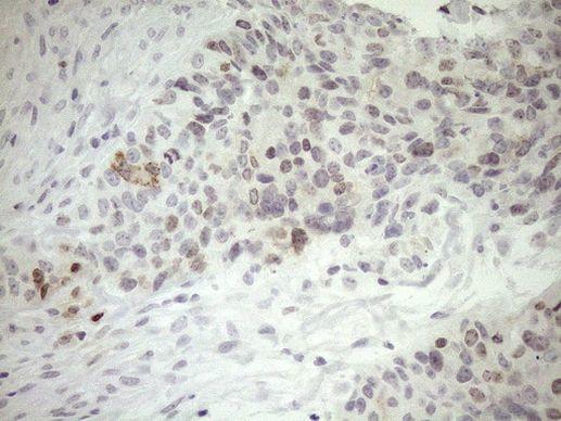 ZNF230 Antibody in Immunohistochemistry (Paraffin) (IHC (P))