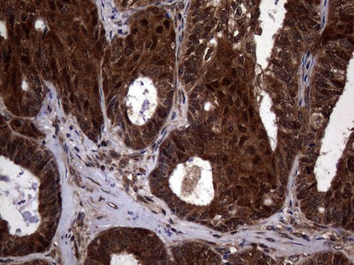 TSN Antibody in Immunohistochemistry (Paraffin) (IHC (P))