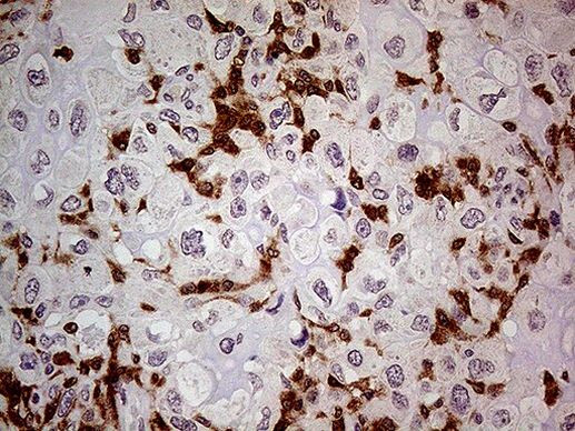 NCF4 Antibody in Immunohistochemistry (Paraffin) (IHC (P))