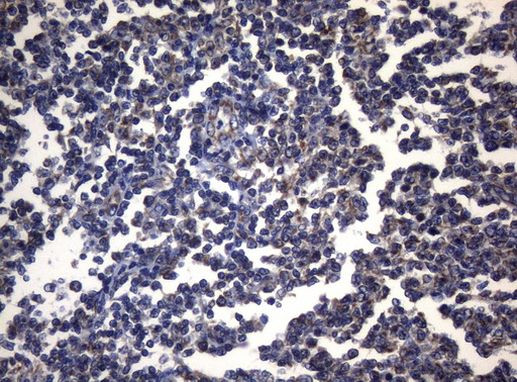 PITPNB Antibody in Immunohistochemistry (Paraffin) (IHC (P))